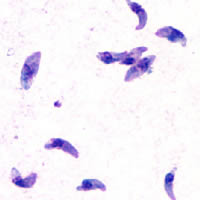 Toxoplasmosis gondii